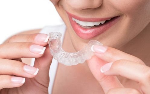 Clear Aligners