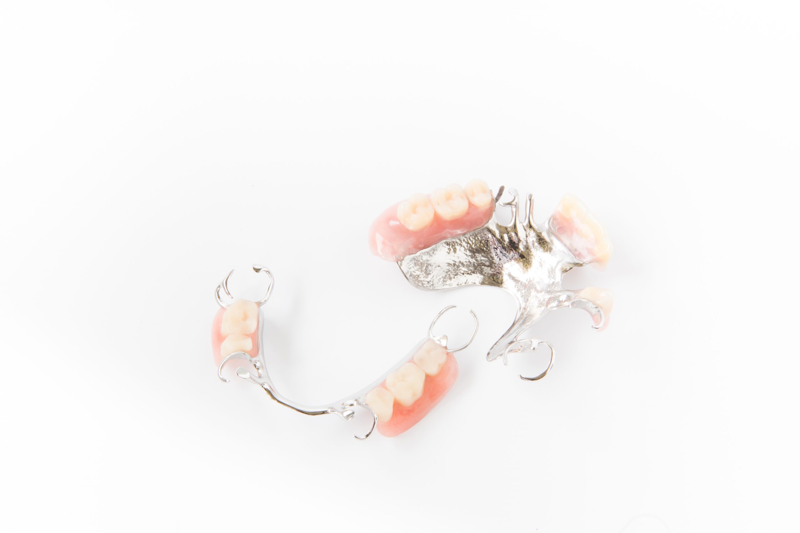 Dentures cast partial